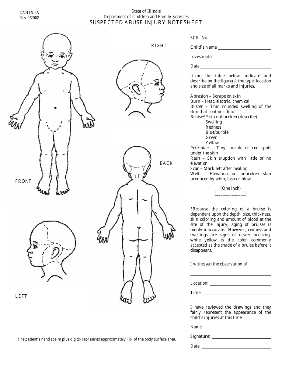 Form CANTS2A Suspected Abuse Injury Notesheet - Infant - Illinois, Page 1