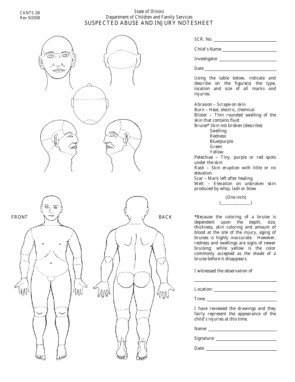 Form CANTS2B Suspected Abuse Injury Notesheet - Child - Illinois, Page 1