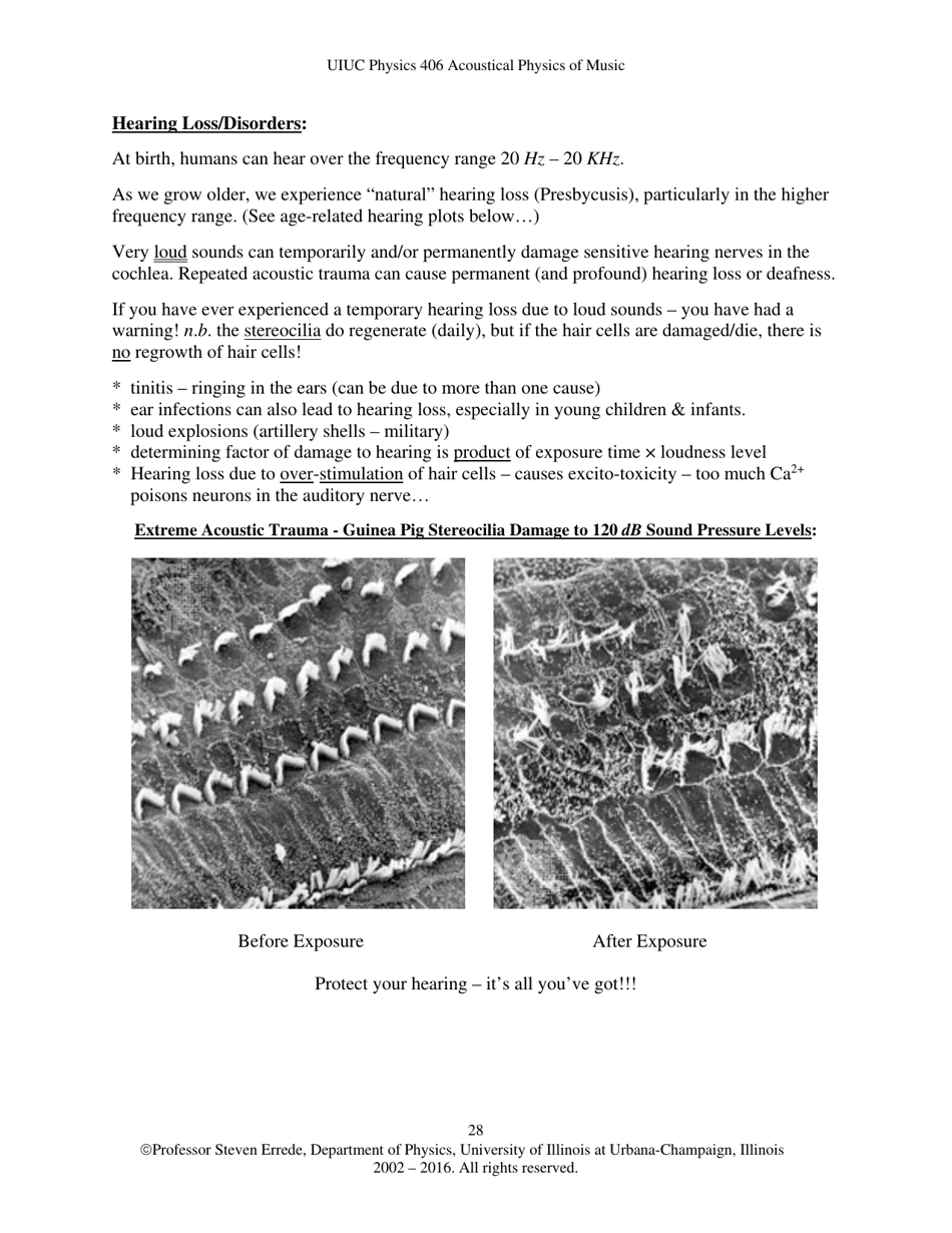 The Human Ear - Hearing, Sound Intensity and Loudness Levels - University of Illinois at Urbana-Champaign, Page 28