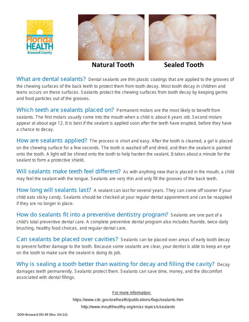 Form DH3204-SSG Consent Form - Dental Sealant Program - Broward County, Florida, Page 2