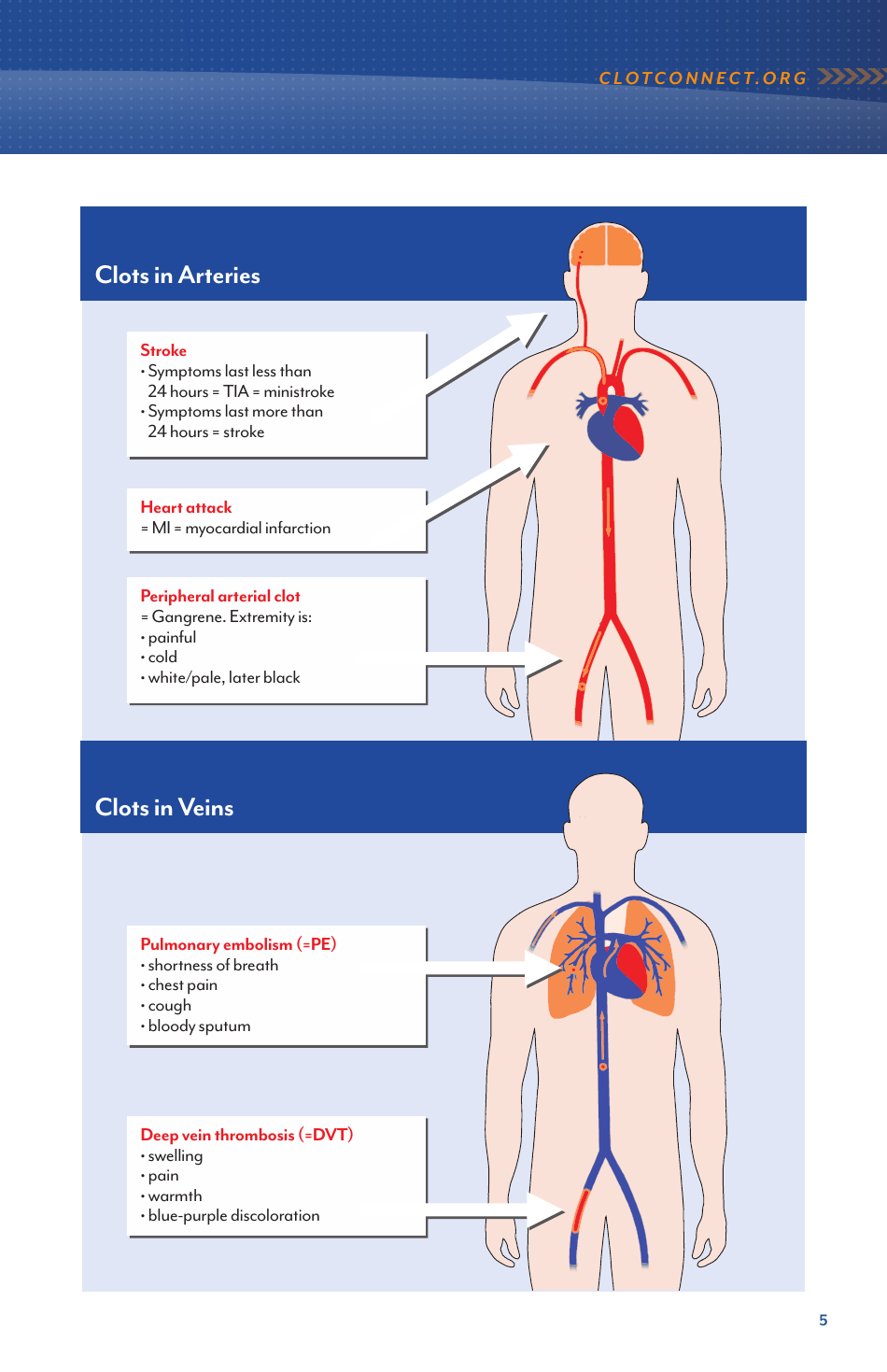 Deep Vein Thrombosis and Pulmonary Embolism - Information for Newly Diagnosed Patients - North Carolina, Page 5