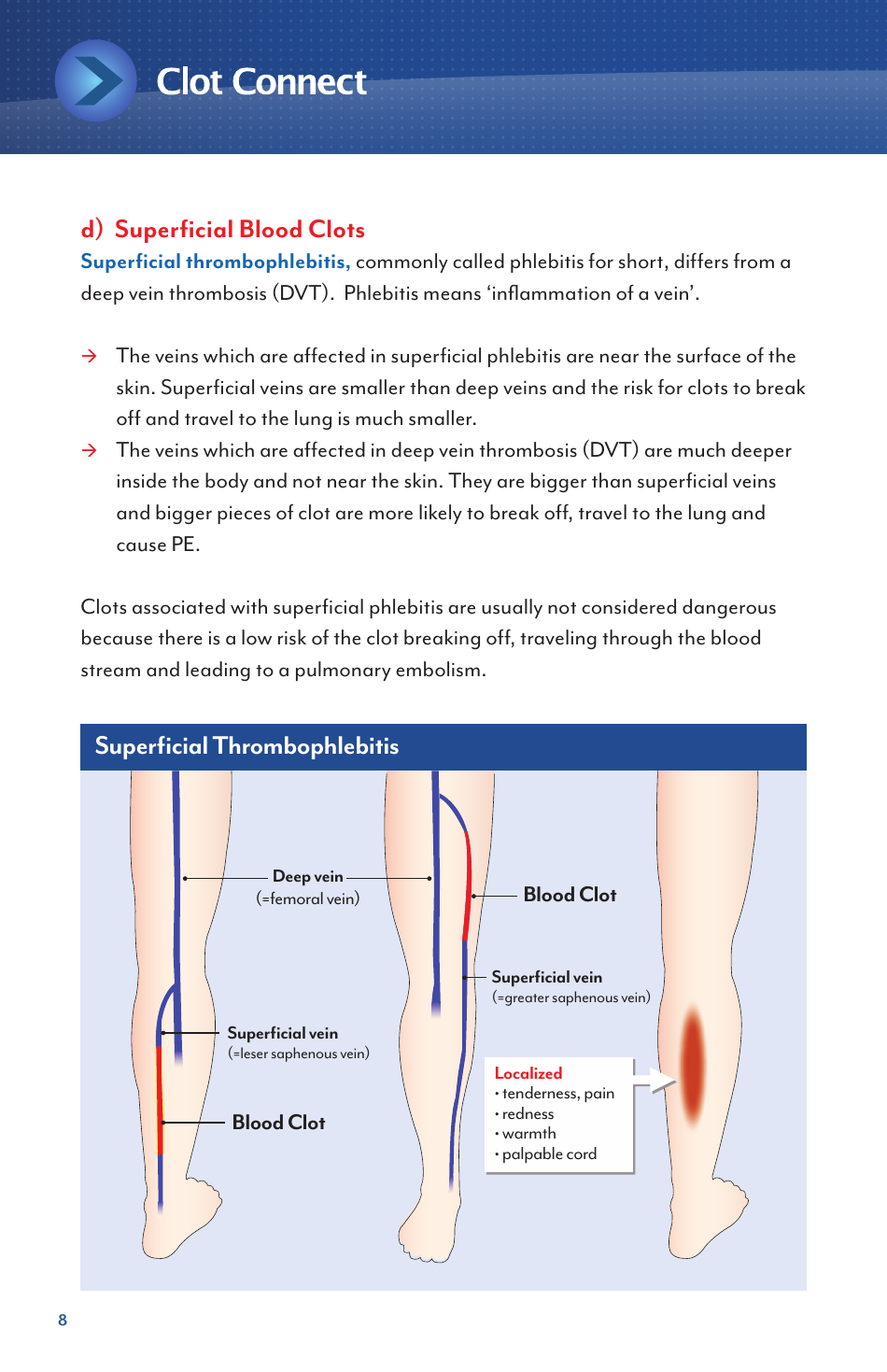 Deep Vein Thrombosis and Pulmonary Embolism - Information for Newly Diagnosed Patients - North Carolina, Page 8