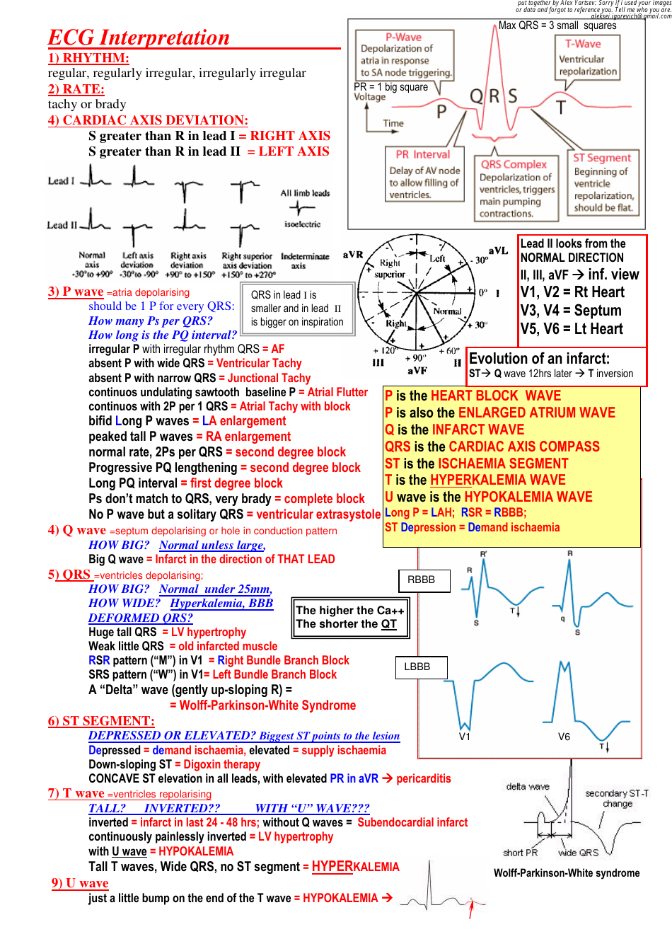 ECG Interpretation Cheat Sheet- Free Download Printable PDF | Templateroller