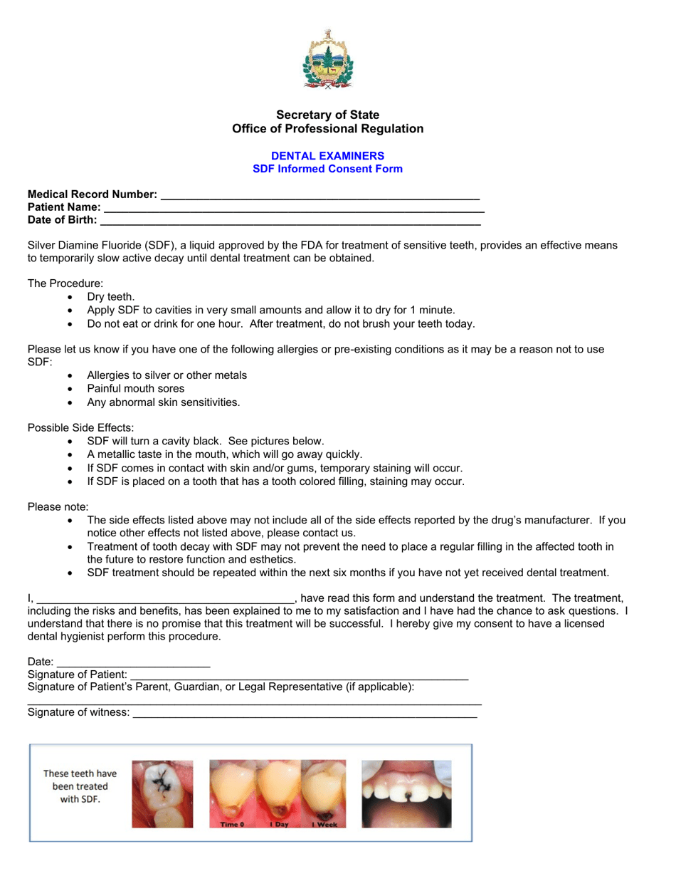 Sdf Informed Consent Form - Dental Examiners - Vermont, Page 1