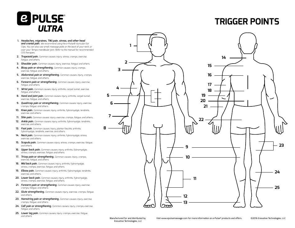 Pain Trigger Points Chart - A Comprehensive Reference Guide