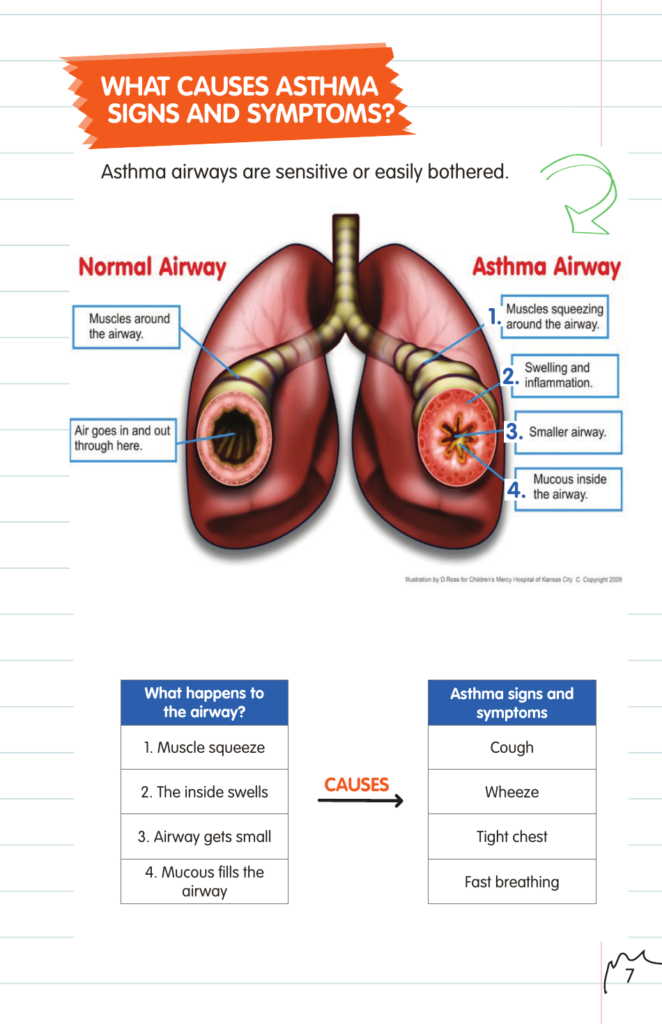 Childrens Asthma Booklet, Page 7