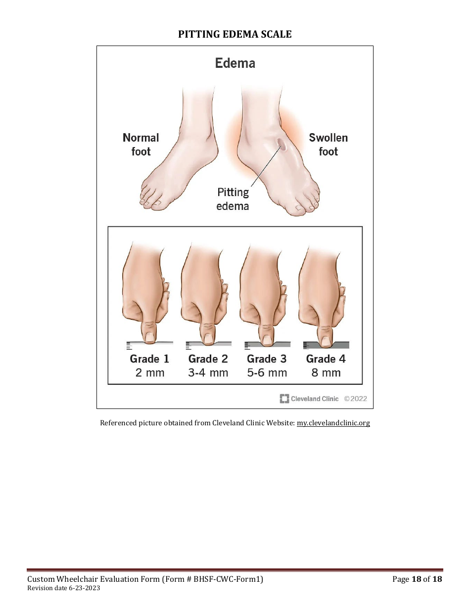 BHSF-CWC Form 1 Custom Wheelchair Evaluation Form - Louisiana, Page 18