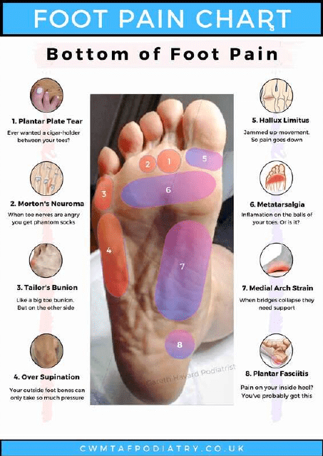 Foot Pain Chart - Bottom of Foot Pain
