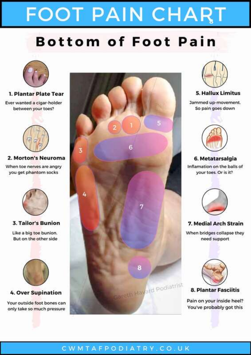 Foot Pain Chart - Bottom of Foot Pain, Page 1