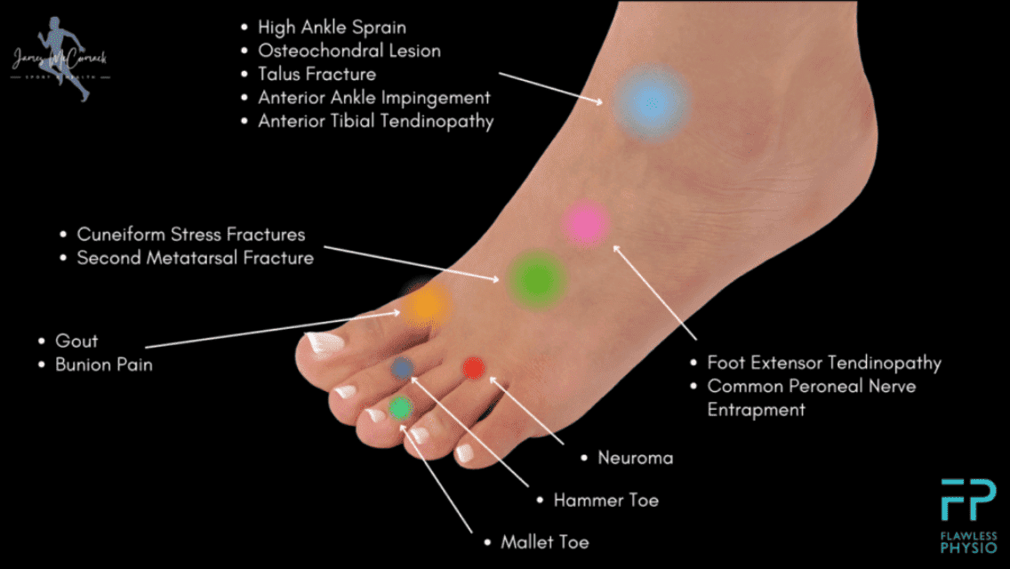 Foot Pain Chart - Black