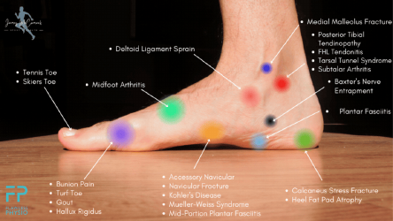 Document preview: Foot Pain Chart - Inner Side