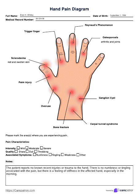Hand Pain Chart - Diagram Download Pdf