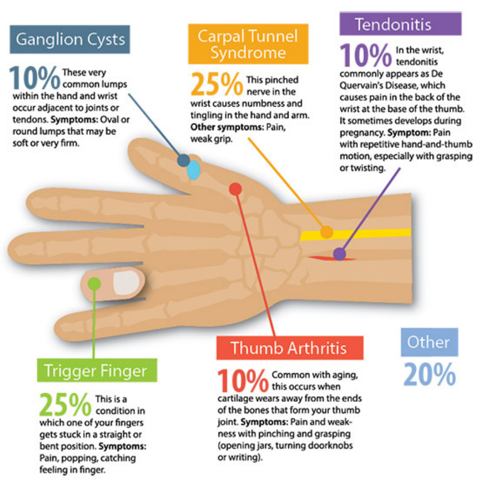 Hand Pain Chart - Varicolored, Page 1