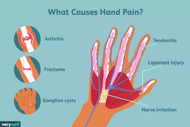 Document preview: Hand Pain Chart - Causes