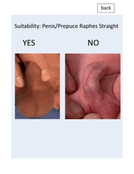 &quot;Patient Circumcision Intake Form - Newborn Health&quot;, Page 11