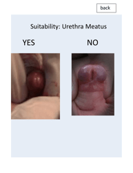 &quot;Patient Circumcision Intake Form - Newborn Health&quot;, Page 13