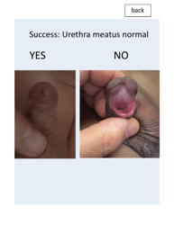 &quot;Patient Circumcision Intake Form - Newborn Health&quot;, Page 18