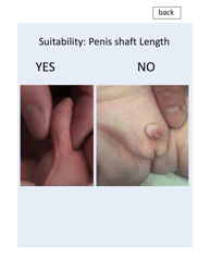 &quot;Patient Circumcision Intake Form - Newborn Health&quot;, Page 3