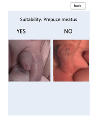 &quot;Patient Circumcision Intake Form - Newborn Health&quot;, Page 7