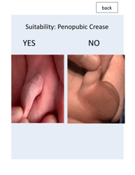 &quot;Patient Circumcision Intake Form - Newborn Health&quot;, Page 8