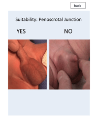 &quot;Patient Circumcision Intake Form - Newborn Health&quot;, Page 9